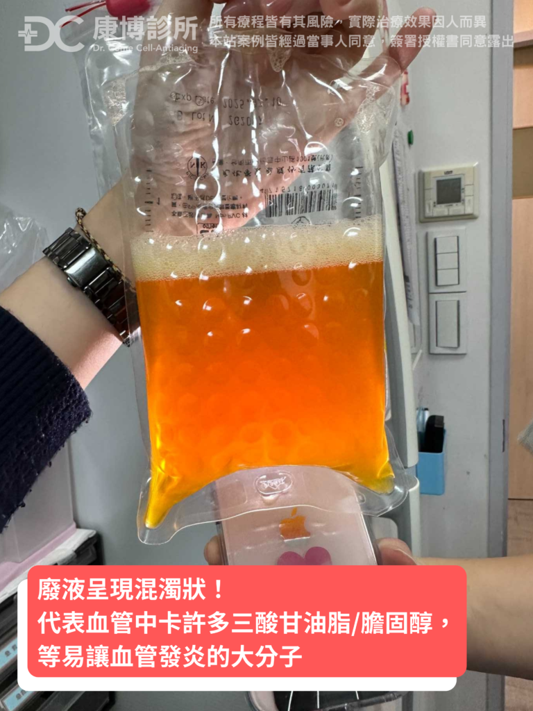 看到洗出的廢液，潘大哥很感謝妹妹為了他的健康這麼擔心，以前總覺得人活著快樂就好，健康不重要，但做完血液淨化，發現整個人舒服很多，才發現人要先健康，才會快樂！